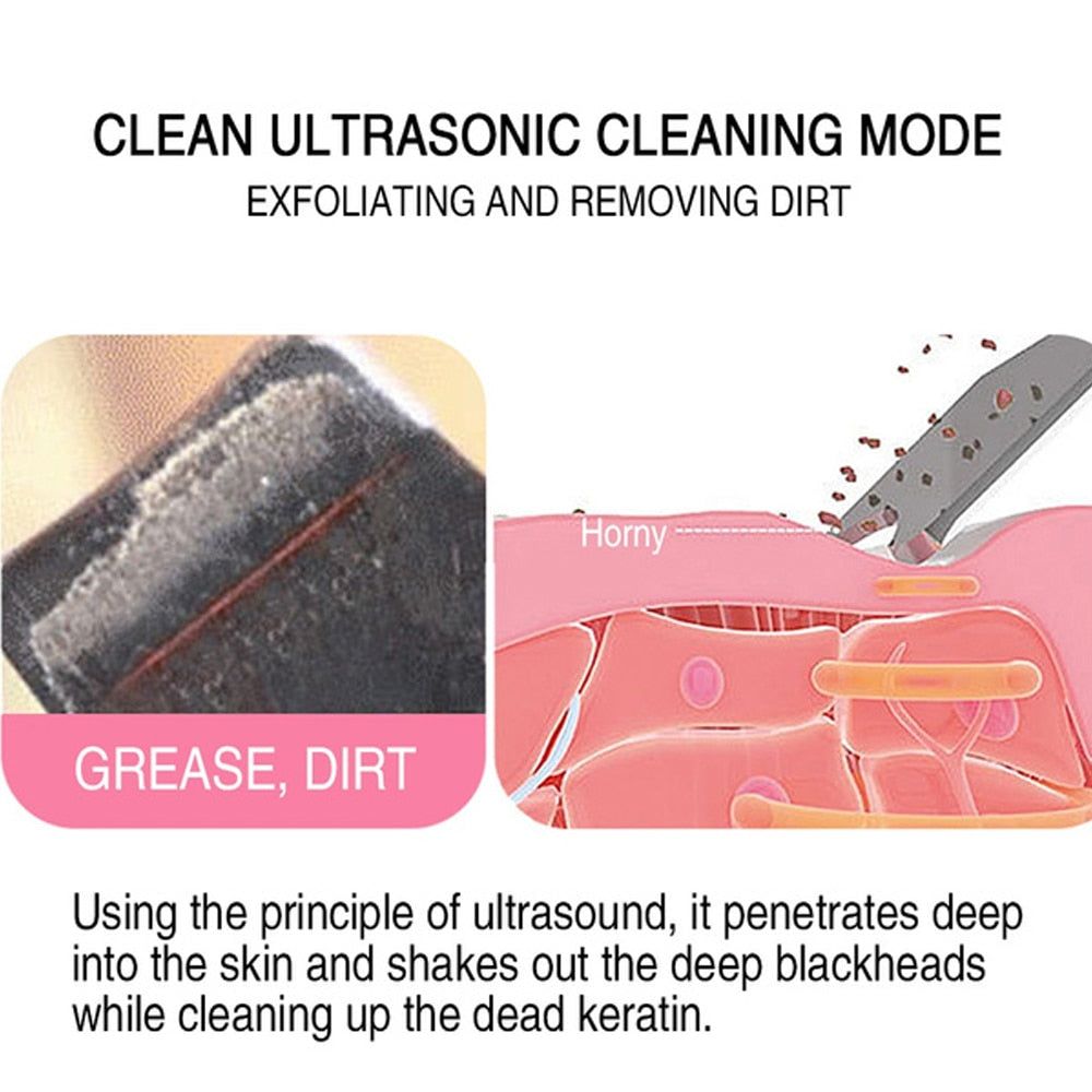 GlowEase™ Skin Scrubber - Your Path to Flawless Skin! - darrenhills