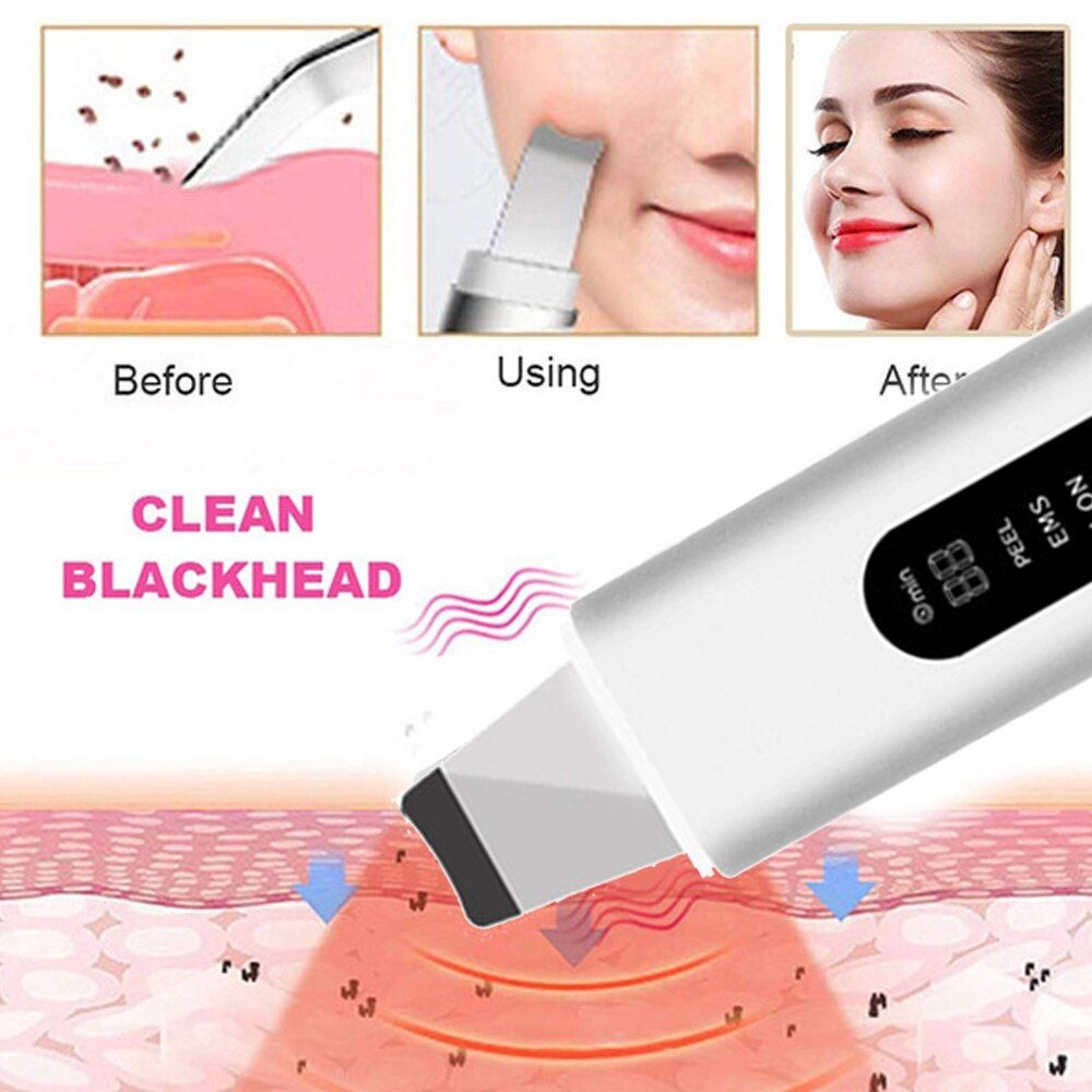 GlowEase™ Skin Scrubber - Your Path to Flawless Skin! - darrenhills